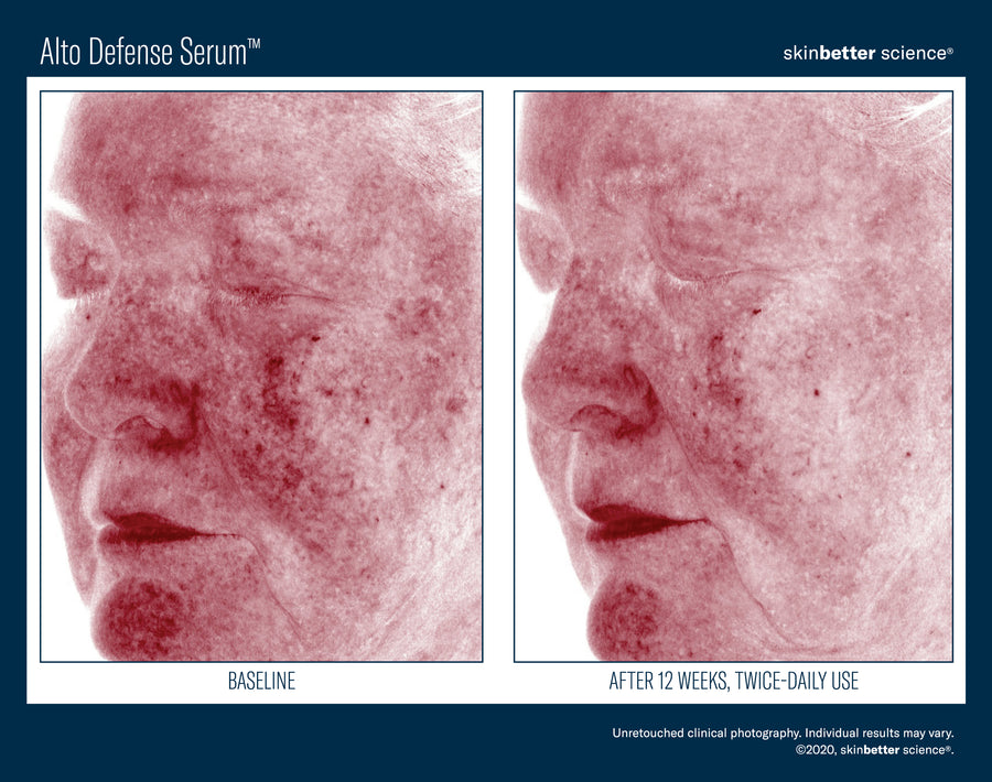 Skinbetter Alto Defense Serum