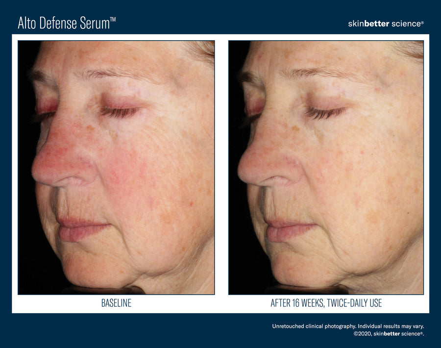 Skinbetter Alto Defense Serum