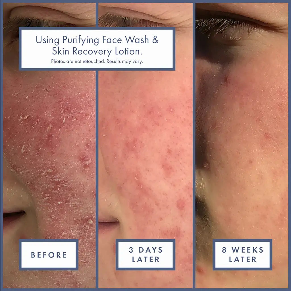 Renée Rouleau Skin Recovery Lotion
