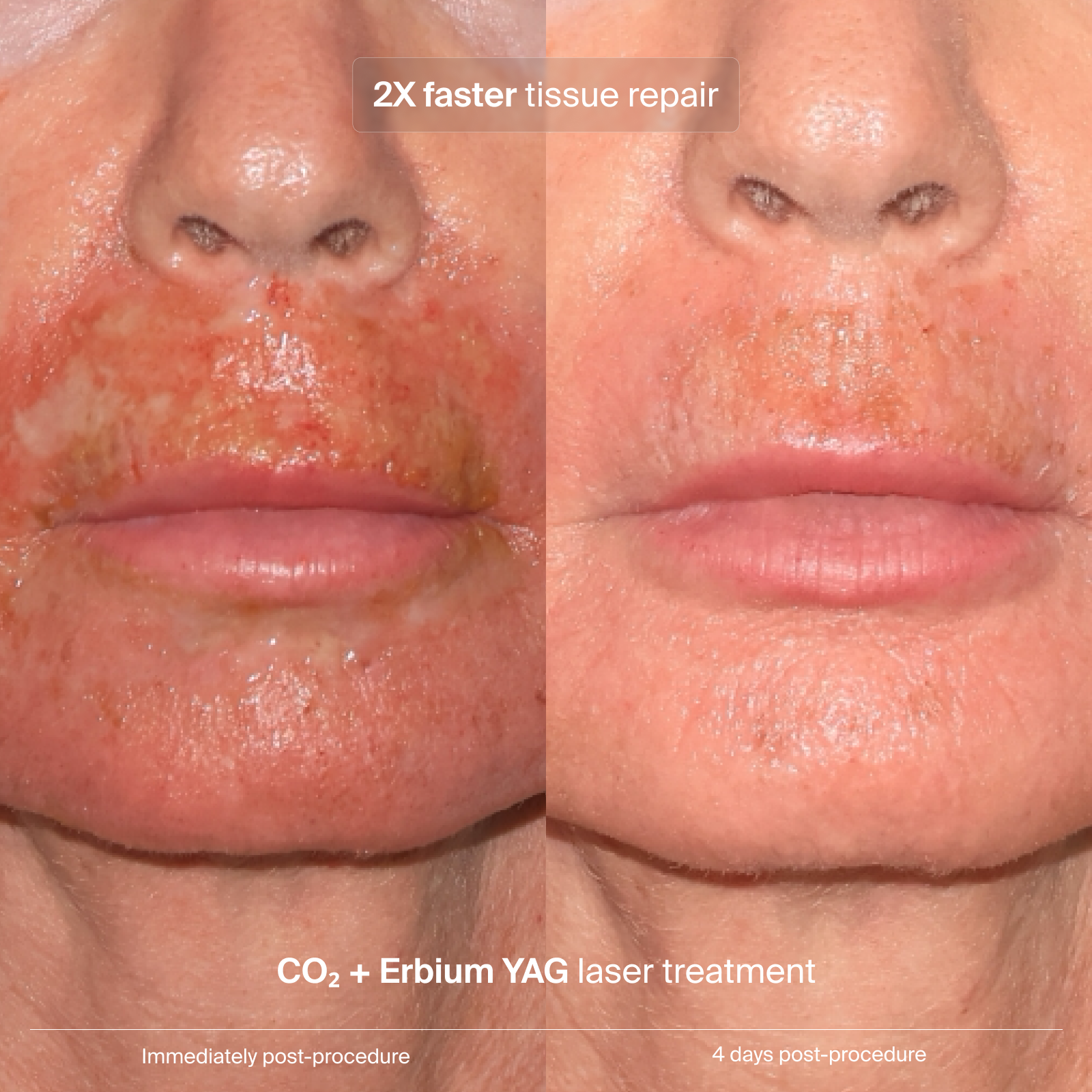 NEW Pavise Extracellular Matrix Restore
