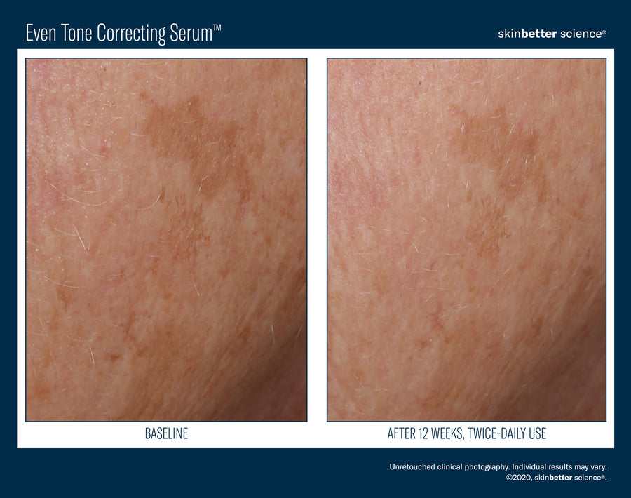 Skinbetter Even Tone Correcting Serum 50 ml