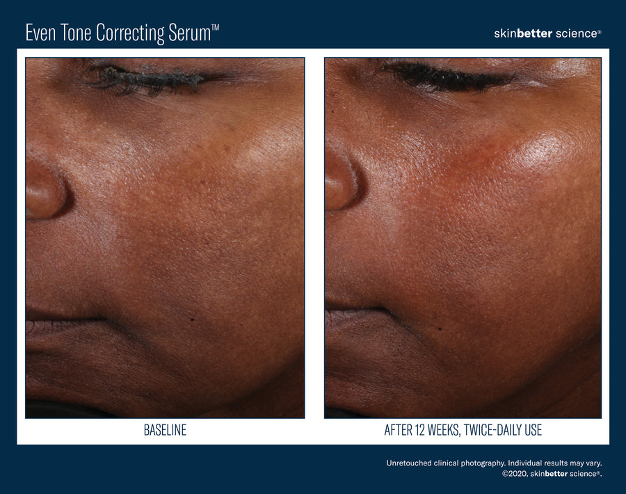 Skinbetter Even Tone Correcting Serum 50 ml