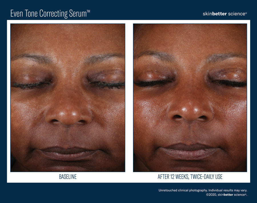Skinbetter Even Tone Correcting Serum 50 ml