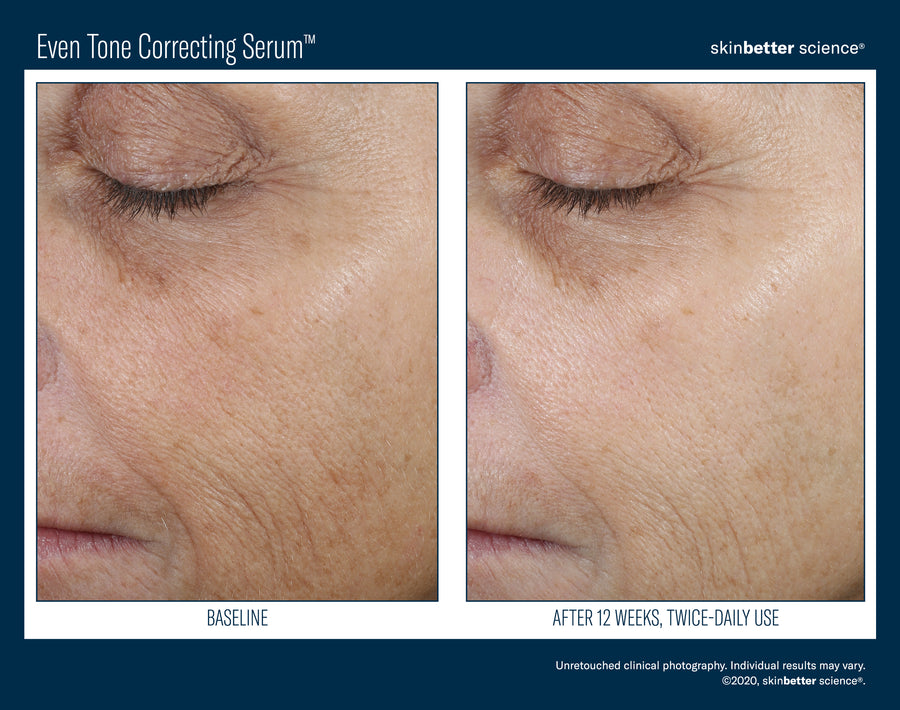 Skinbetter Even Tone Correcting Serum 50 ml