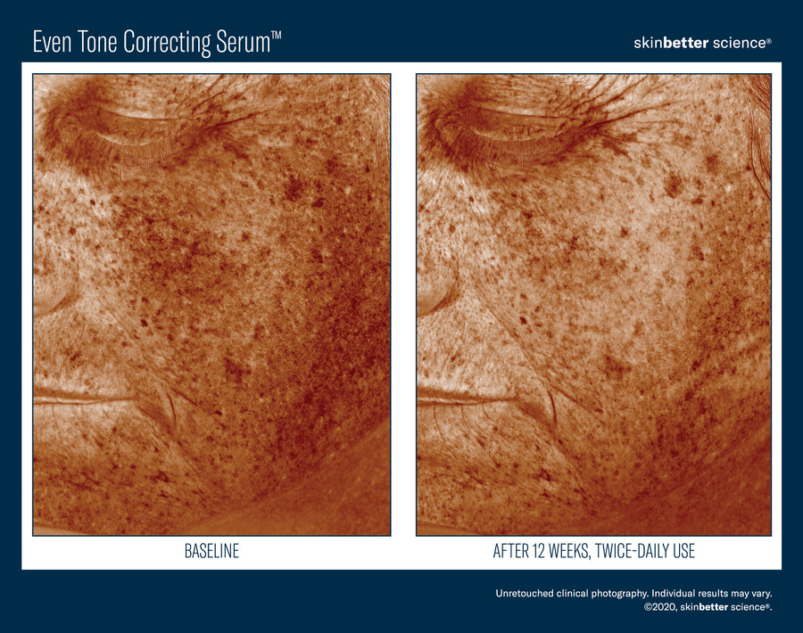 Skinbetter Even Tone Correcting Serum 50 ml