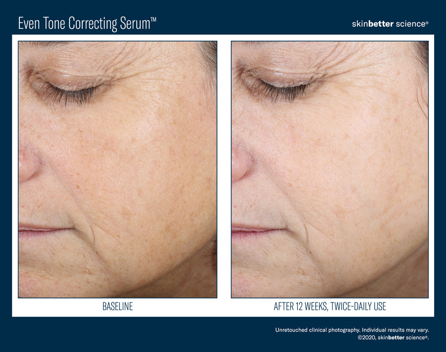 Skinbetter Even Tone Correcting Serum 50 ml
