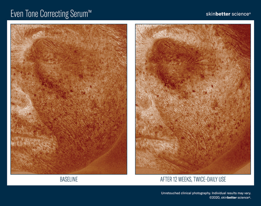 Skinbetter Even Tone Correcting Serum 50 ml