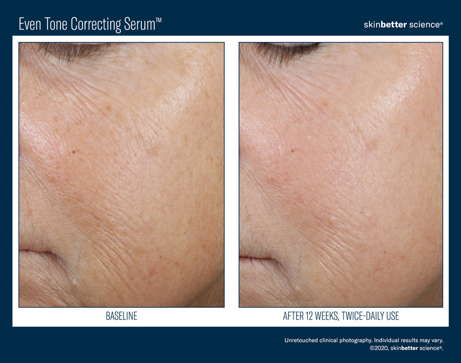 Skinbetter Even Tone Correcting Serum 50 ml