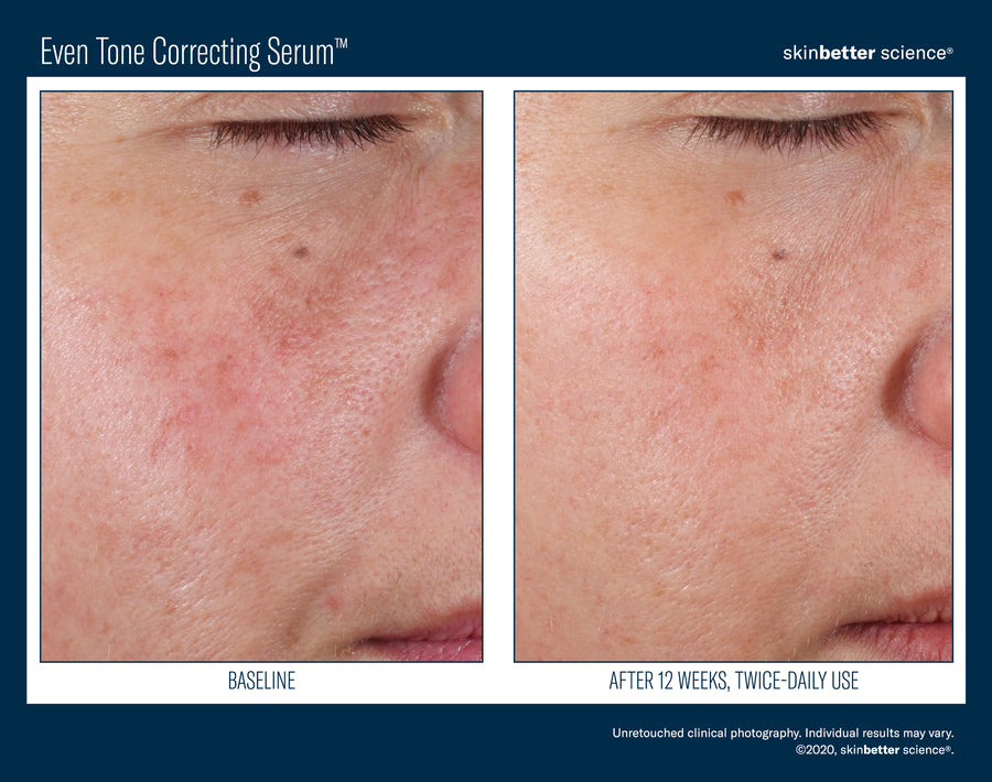 Skinbetter Even Tone Correcting Serum 50 ml