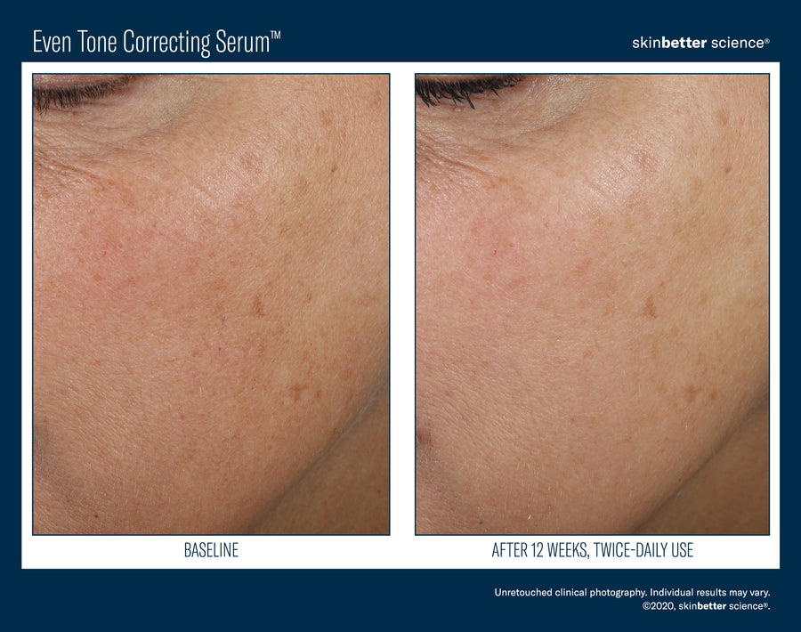 Skinbetter Even Tone Correcting Serum 50 ml