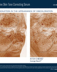 SkinBetter Science Even Intensive Skin Tone Correcting Serum
