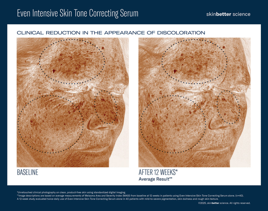 SkinBetter Science Even Intensive Skin Tone Correcting Serum