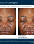 SkinBetter Science Even Intensive Skin Tone Correcting Serum