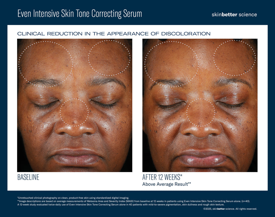 SkinBetter Science Even Intensive Skin Tone Correcting Serum