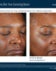 SkinBetter Science Even Intensive Skin Tone Correcting Serum