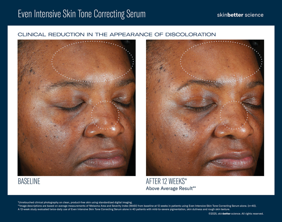 SkinBetter Science Even Intensive Skin Tone Correcting Serum
