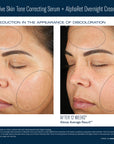 SkinBetter Science Even Intensive Skin Tone Correcting Serum