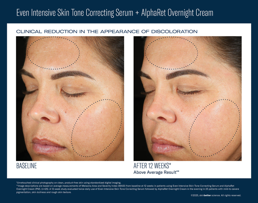 SkinBetter Science Even Intensive Skin Tone Correcting Serum
