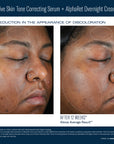 SkinBetter Science Even Intensive Skin Tone Correcting Serum