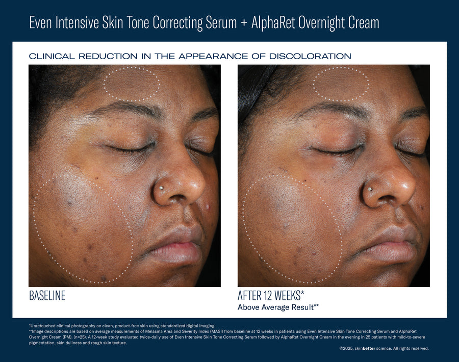 SkinBetter Science Even Intensive Skin Tone Correcting Serum
