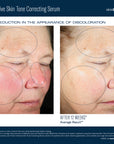 SkinBetter Science Even Intensive Skin Tone Correcting Serum