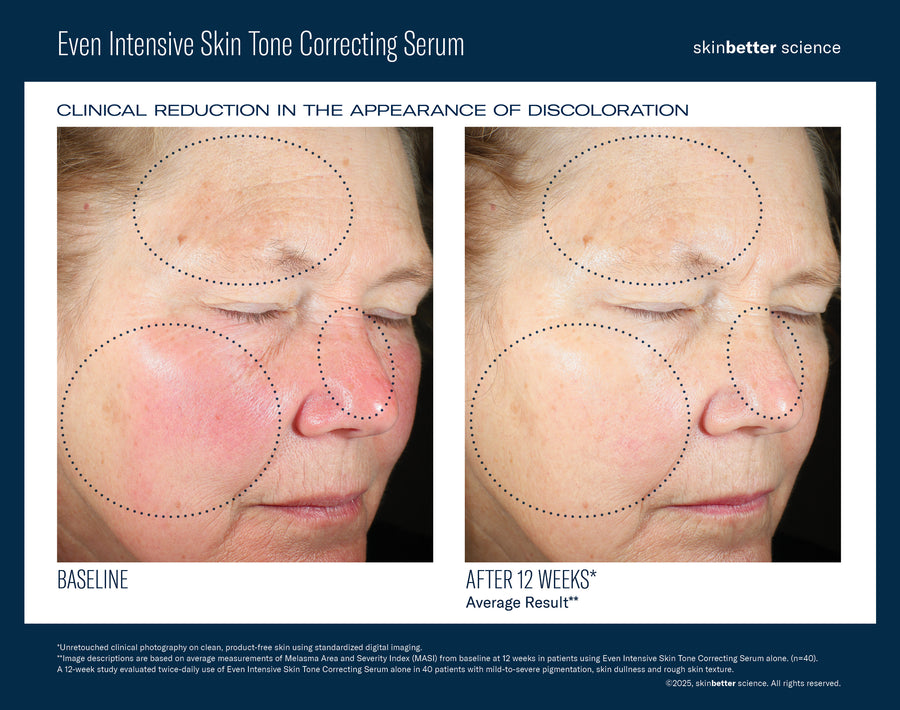 SkinBetter Science Even Intensive Skin Tone Correcting Serum