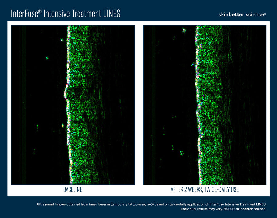 Skinbetter InterFuse Intensive Treatment LINES