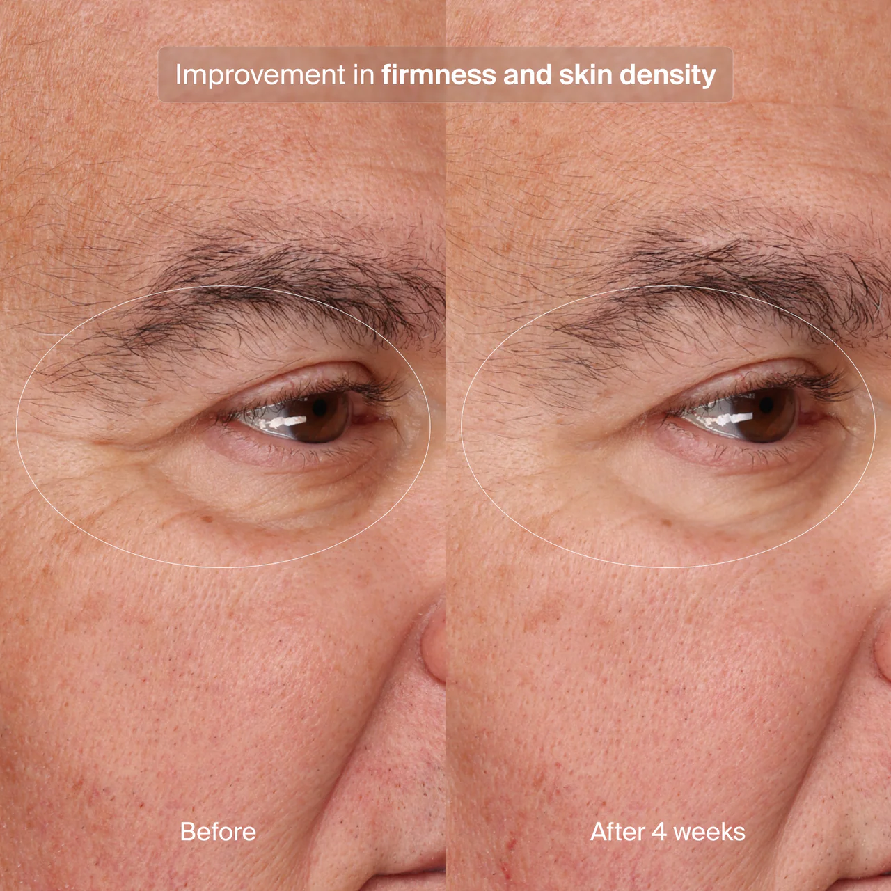 Pavise Precision Eye Lift