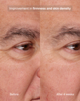 Pavise Precision Eye Lift