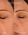 Pavise Precision Eye Lift