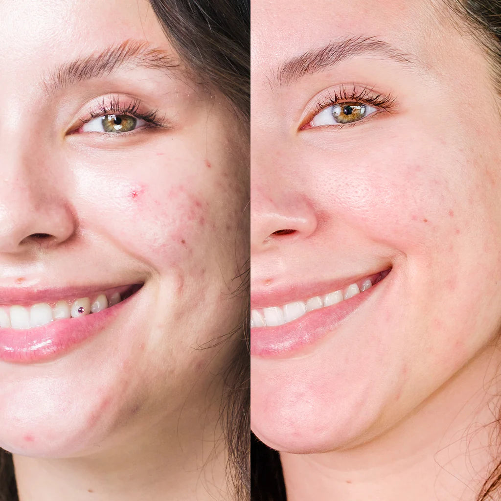 Renée Rouleau HyperFix Fading Toner