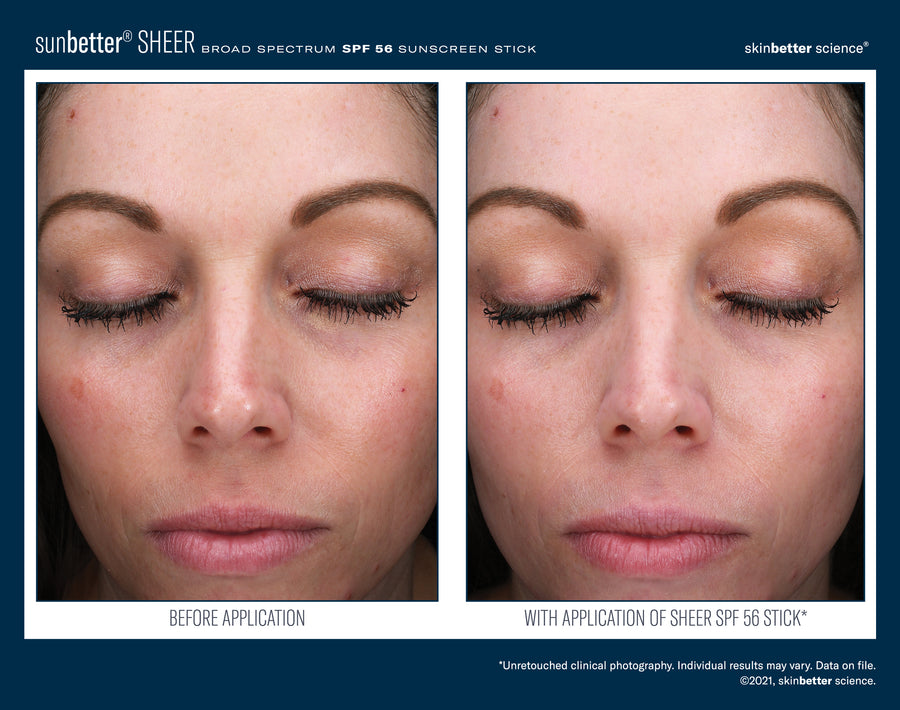 Skinbetter sunbetter SHEER SPF 56 Sunscreen Stick