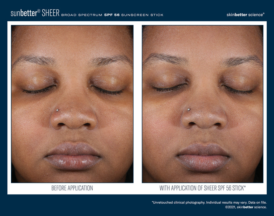 Skinbetter sunbetter SHEER SPF 56 Sunscreen Stick