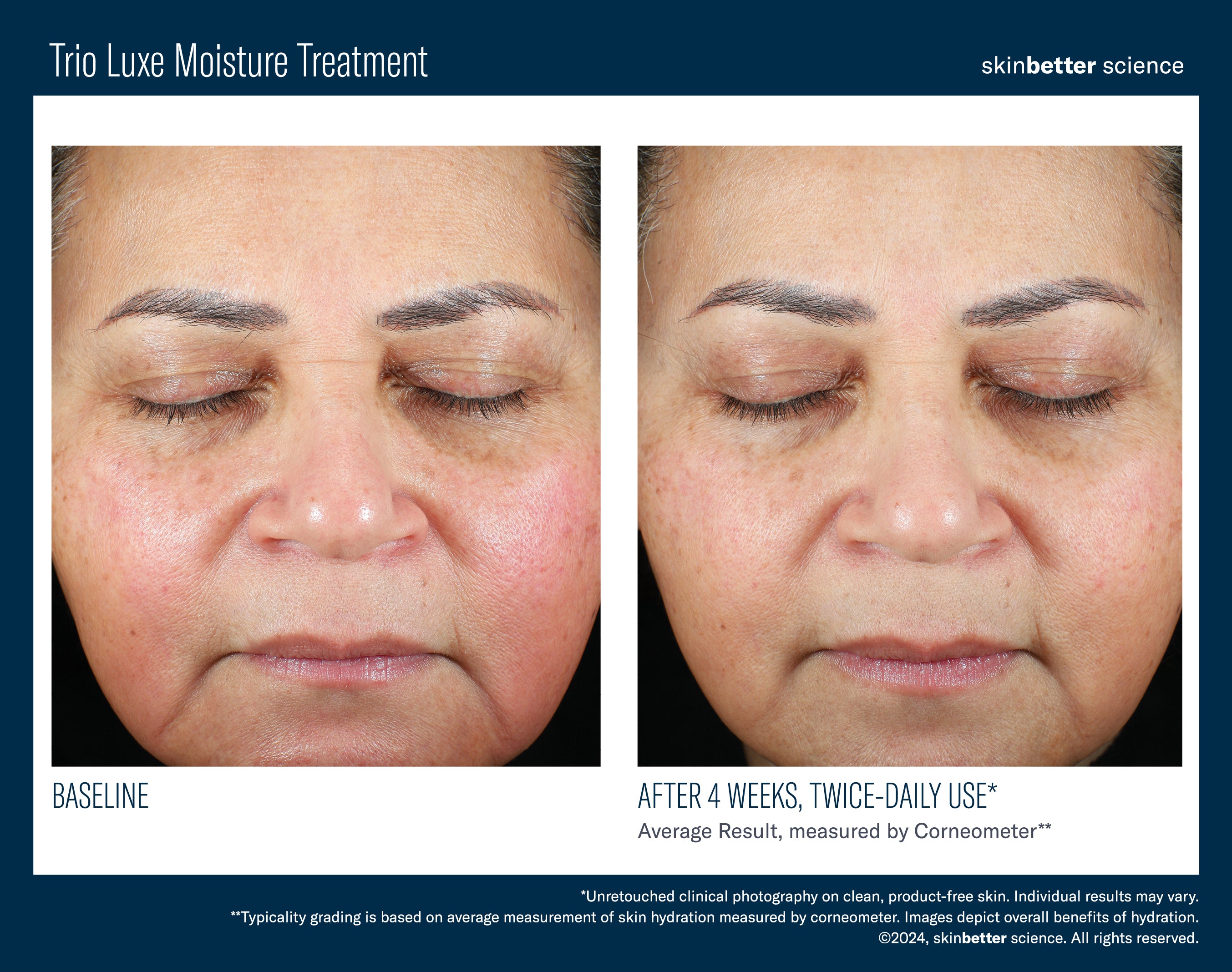 Skinbetter Trio Luxe Moisture Treatment