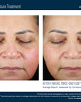 Skinbetter Trio Luxe Moisture Treatment