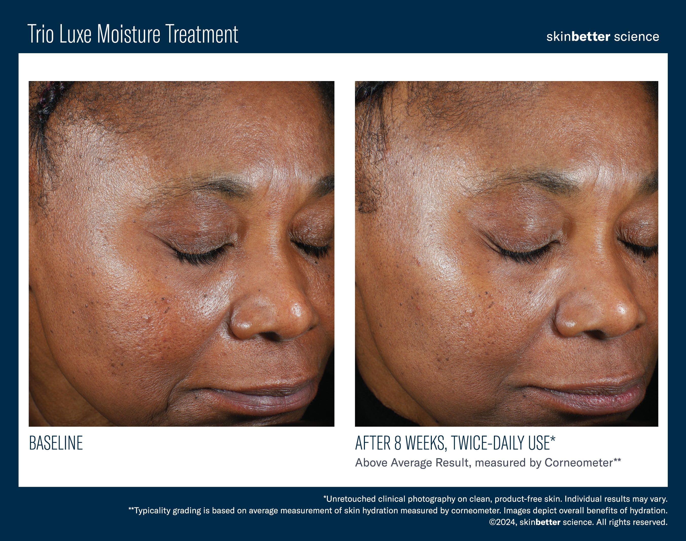 Skinbetter Trio Luxe Moisture Treatment