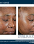 Skinbetter Trio Luxe Moisture Treatment