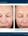 Skinbetter Trio Luxe Moisture Treatment