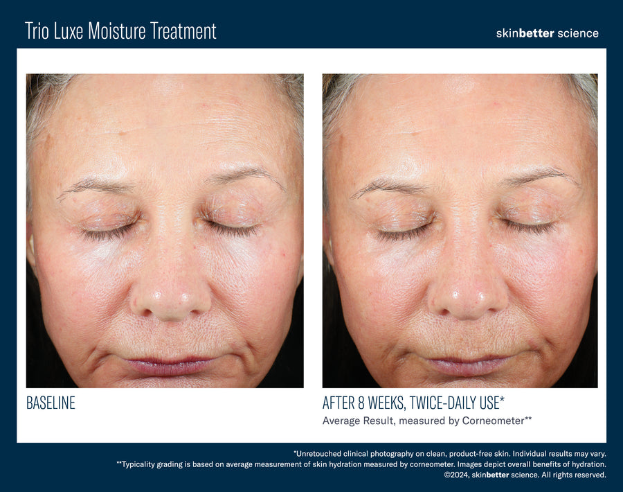 Skinbetter Trio Luxe Moisture Treatment