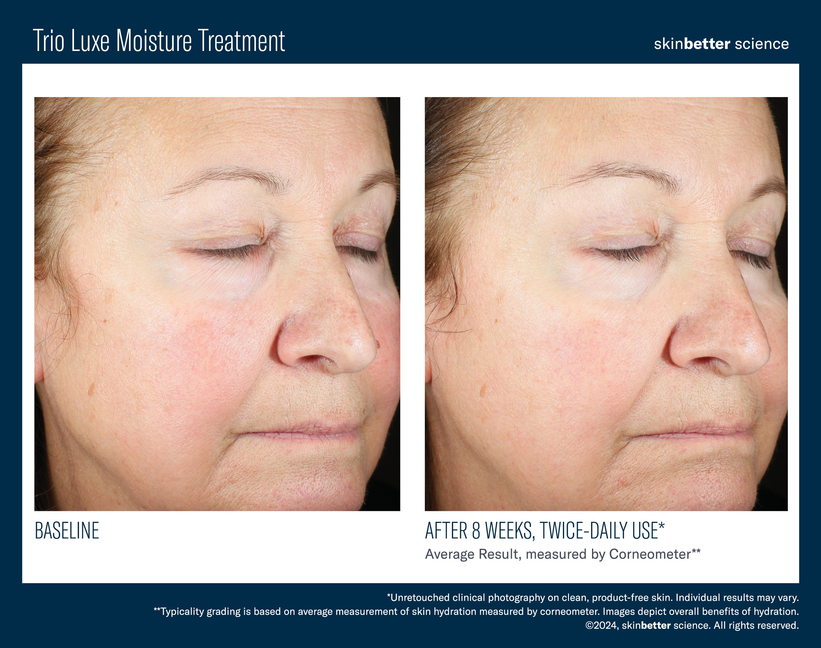 Skinbetter Trio Luxe Moisture Treatment