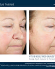 Skinbetter Trio Luxe Moisture Treatment