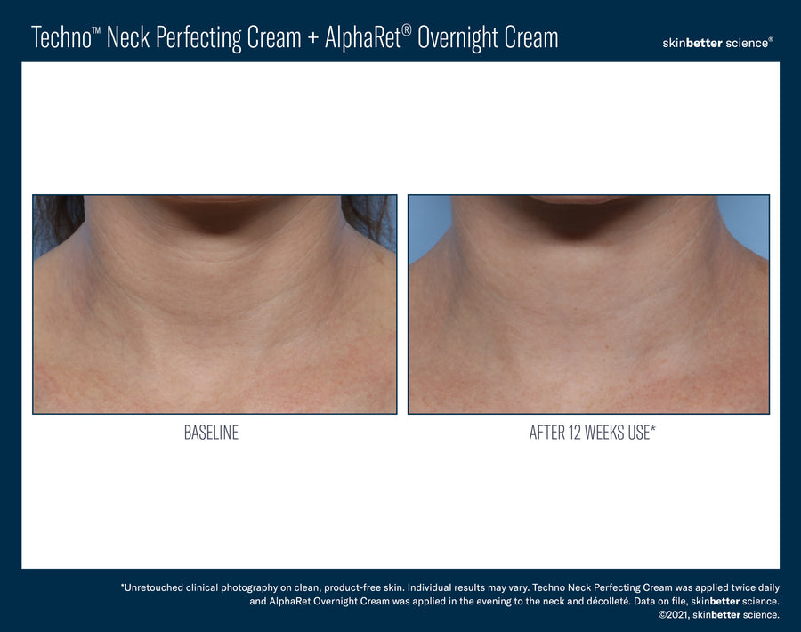 Skinbetter Techno Neck Perfecting Cream