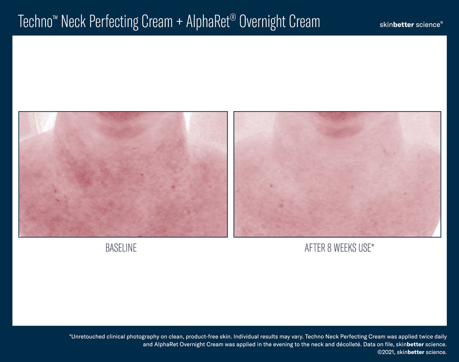 Skinbetter Techno Neck Perfecting Cream