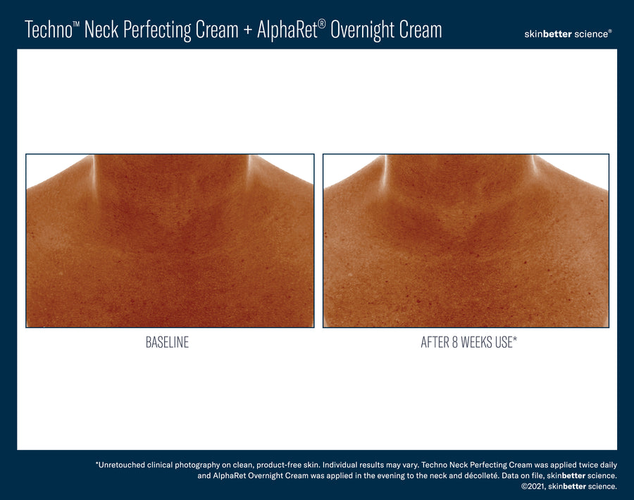 Skinbetter Techno Neck Perfecting Cream