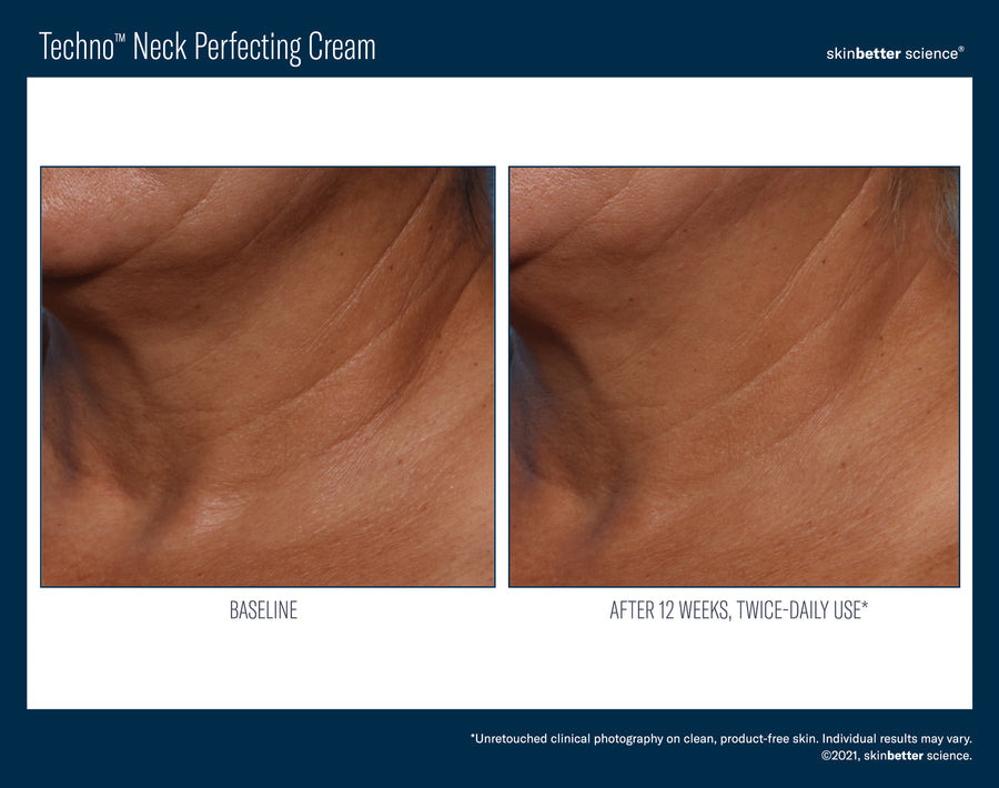 Skinbetter Techno Neck Perfecting Cream