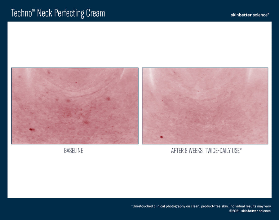 Skinbetter Techno Neck Perfecting Cream