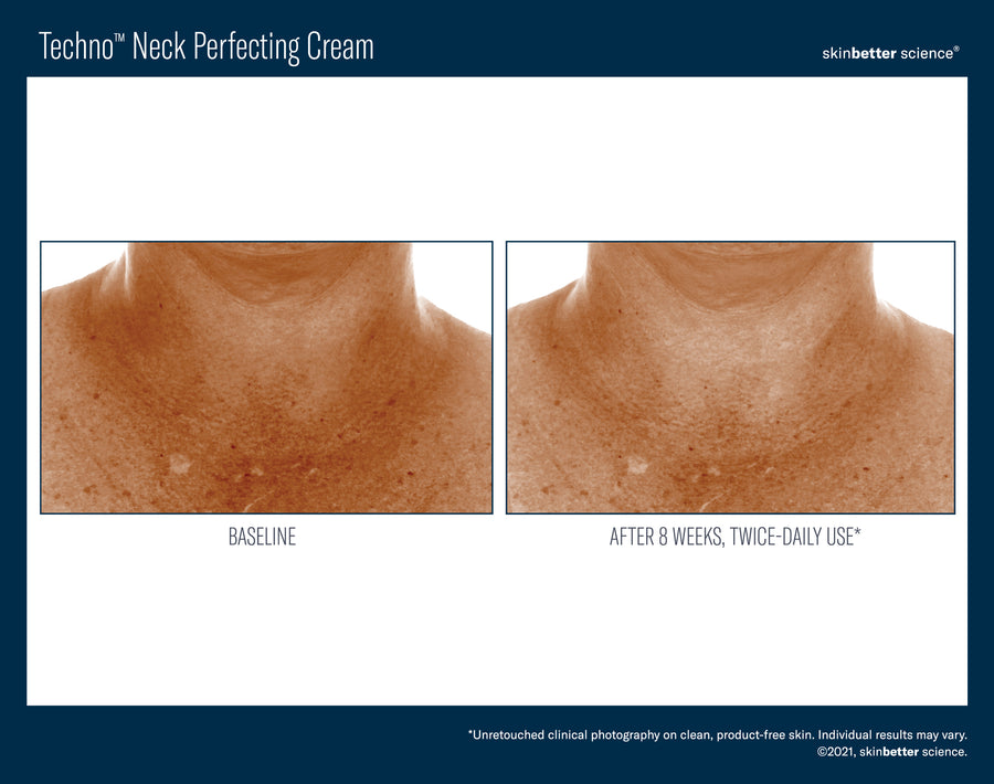 Skinbetter Techno Neck Perfecting Cream