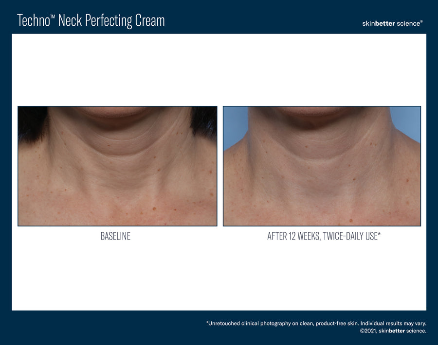 Skinbetter Techno Neck Perfecting Cream