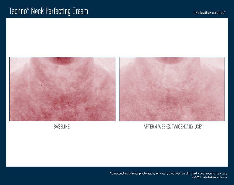 Skinbetter Techno Neck Perfecting Cream