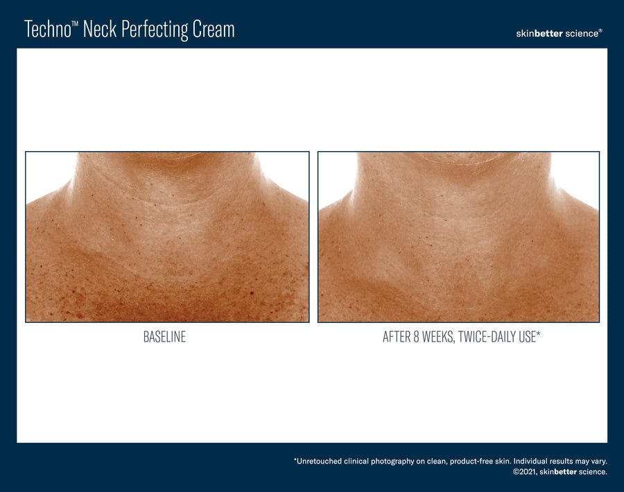 Skinbetter Techno Neck Perfecting Cream